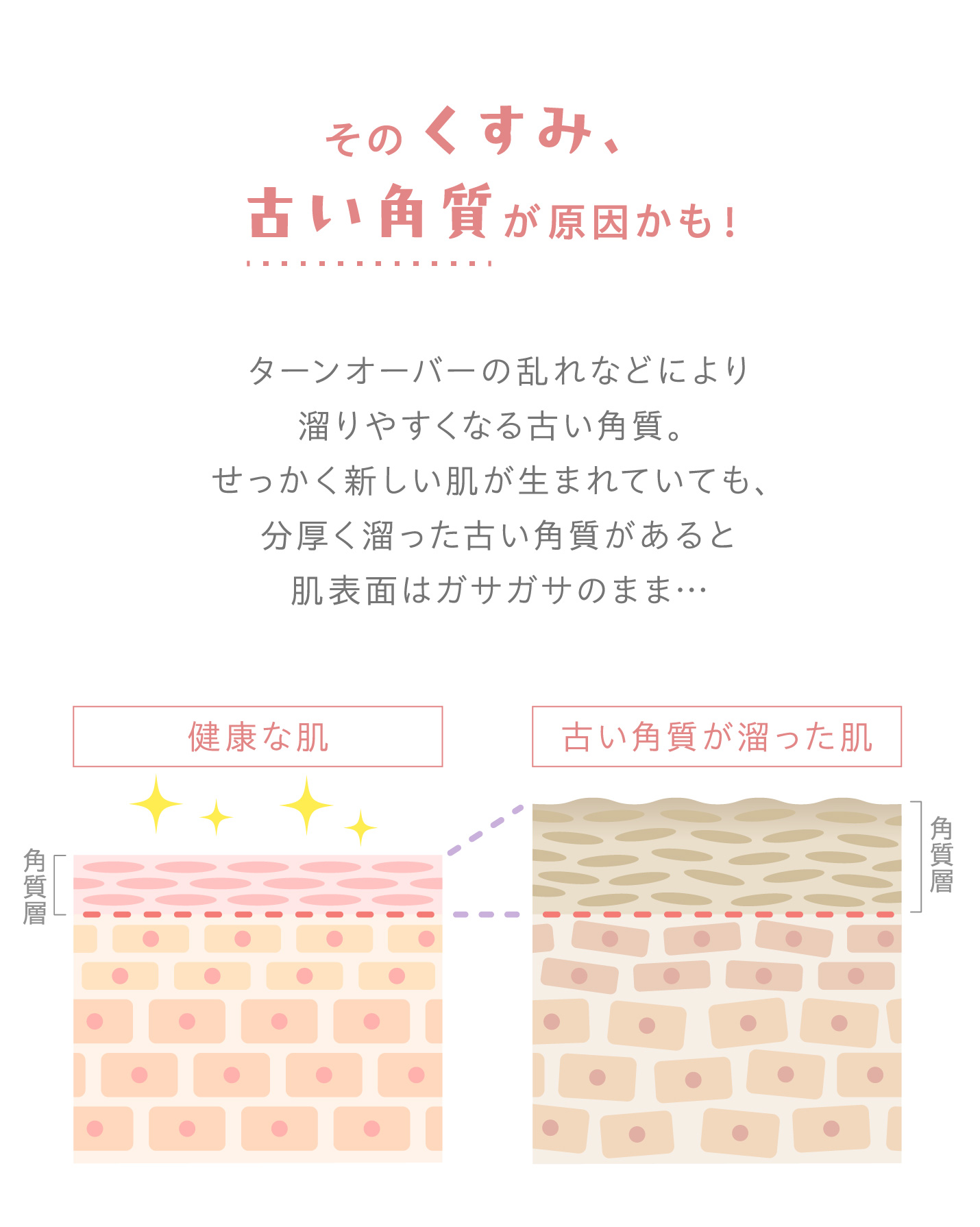 そのくすみ、古い角質が原因かも！
