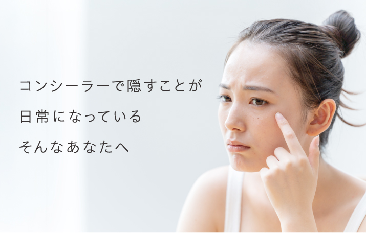 コンシーラーで隠すことが日常になっている。そんなあなたへ。