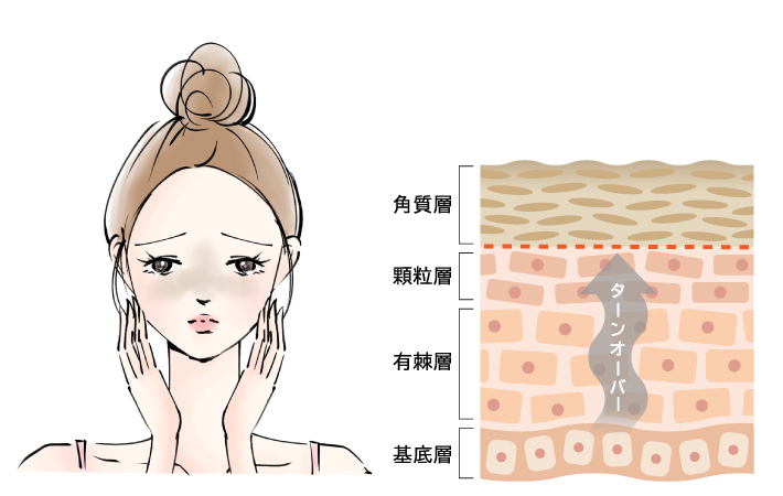 ターンオーバーが乱れ角質が厚くなると、くすみの原因に。