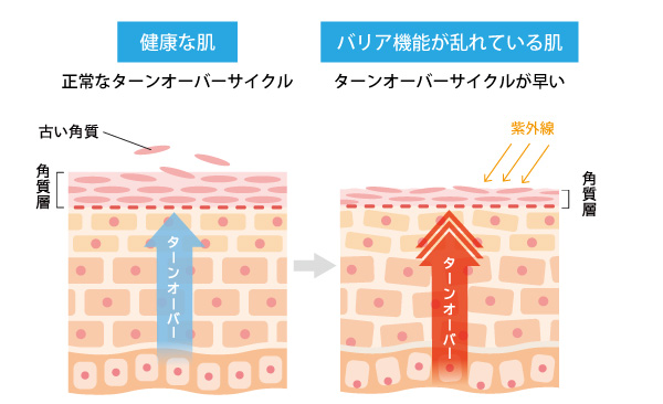 肌の断面図